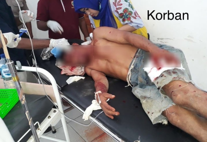 Korban saat mendapat pertolongan medis di rumah sakit, Butur. (Foto : Dok. SULTRAKINI.COM)