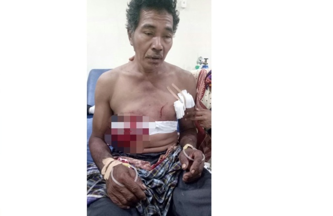 Jafarudin (50) korban dari gigitan buaya. (Foto: Ist).