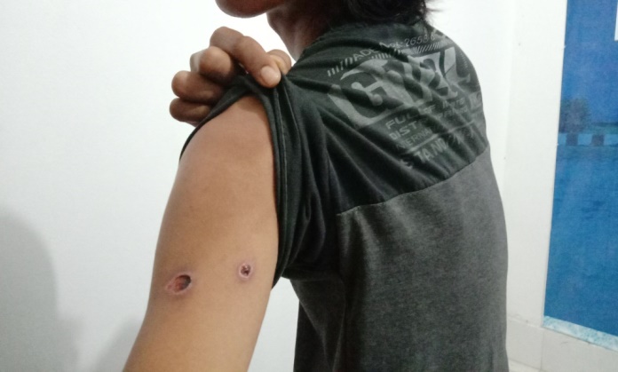 Korban yang merupakan mahasiswa diduga terkena tembakan saat aksi unjuk rasa di Kantor DPRD Sultra pada 26 September 2019. (Foto: Hasrul Tamrin/SULTRAKINI.COM)