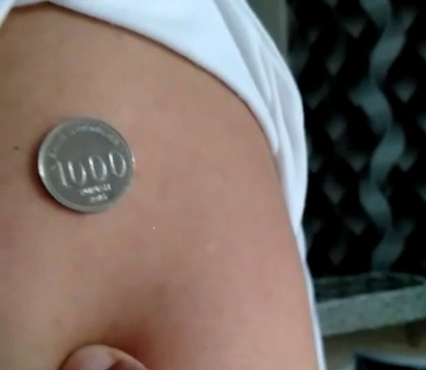 Cuplikan konten salah satu video yang beredar di masyarakat memperlihatka koin seribu rupiah nempel di bekas suntikan vaksin. (Foto: Repro Video)