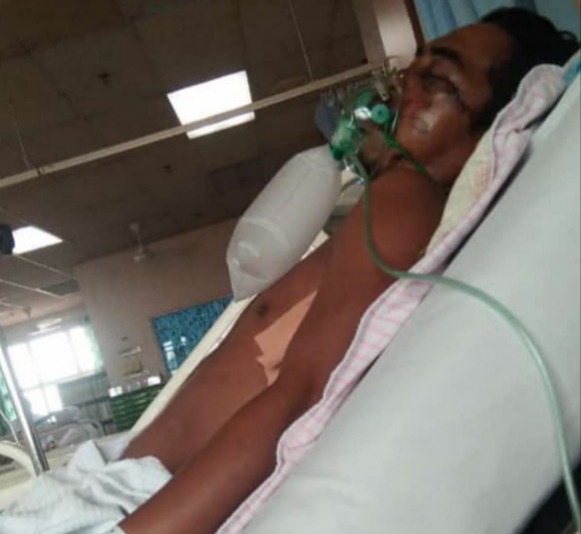 Korban Korban Yai (37) masih dirawat di ruang ICU (Foto: Ist)